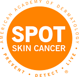 Spot Skin Cancer